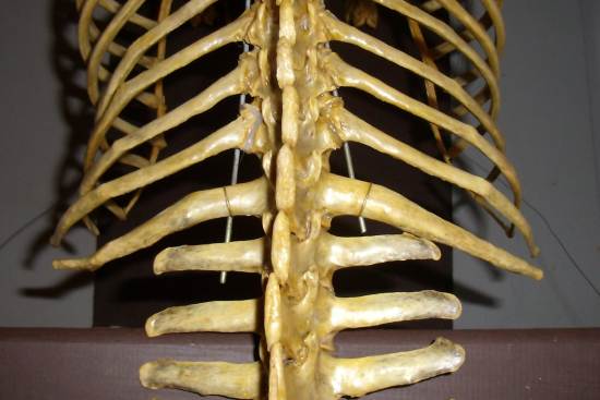 The lumbar and sacral vertebrae