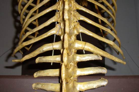 2012_March_17_11_lumbar_vertebrae.jpg