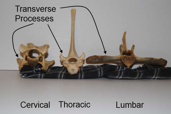 2012_Sept_7_5_equine_vertebrae_transverse_processes.jpg