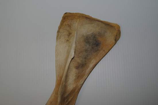 2011_Oct_21_7_cartilage_attachment_point_on_scapula.jpg