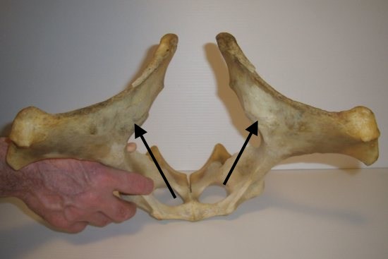 2012_March_17_7_lumbar_vertebrae.jpg