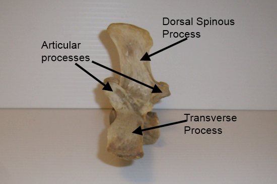 2012_March_17_2__lumbar_vertebrae.jpg