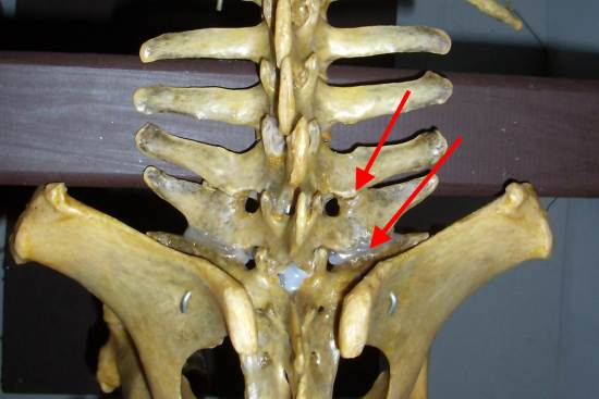 The lumbar and sacral vertebrae