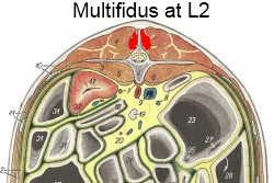 2012_Oct_8_5_Multifidus_L2.jpg