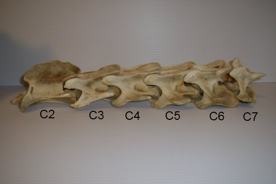 The cervical (neck) vertebrae and how they move