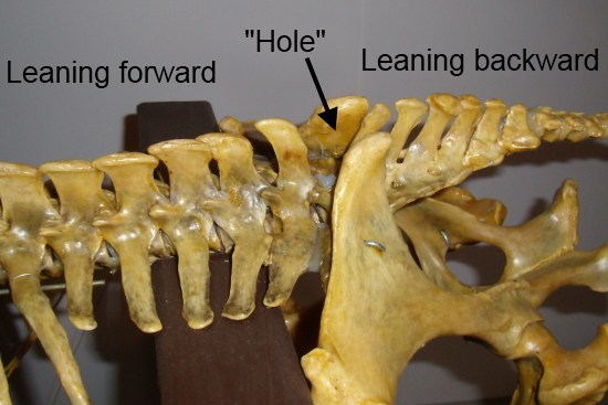 2012_March_17_8_lumbar_vertebrae.jpg