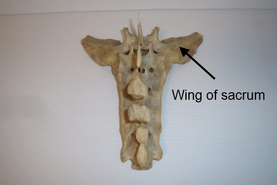 2012_March_17_5_lumbar_vertebrae.jpg