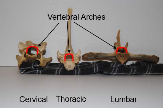 2012_Jan_28_6_equine_vertebrae.jpg