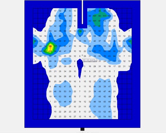 2016 March 4 4 center marked straight pressure marked.jpg