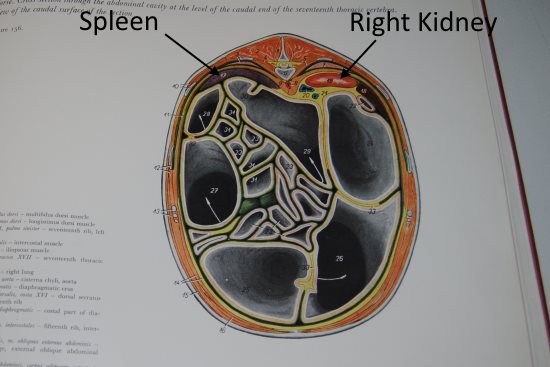 2016 May 11 6 caudal 17th vert 19  right kidney.jpg