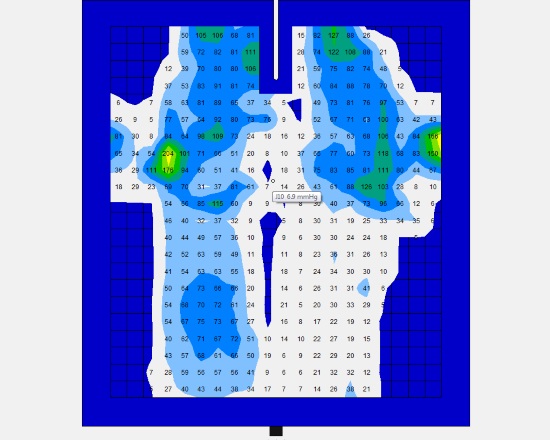 2016 March 4 13 tape straight 1 pressure marked.jpg