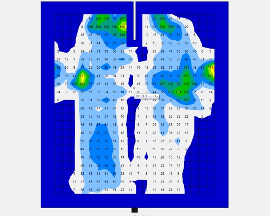 2016 March 4 10 tape straight 2 pressure marked.jpg