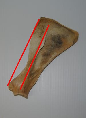 2015 May 26 4 left scapula lateral view.jpg